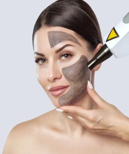 Carbón activo + Neodominio yag